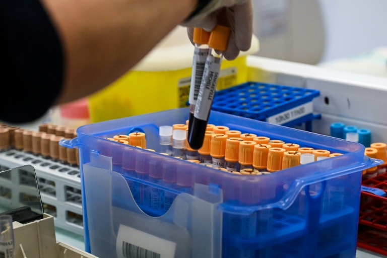 Le réseau de laboratoires de biologie médicale Cerballiance en France a annoncé vendredi avoir été victime fin mars d'une attaque informatique ayant entraîné 