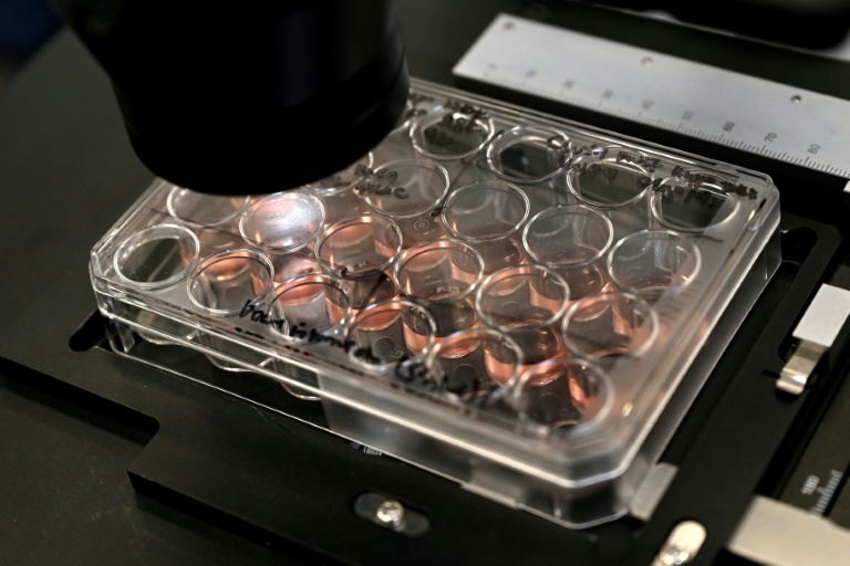 Des cellules cérébrales humaines cultivées dans le laboratoire de l'entreprise australienne Cortical Labs à Melbourne, le 5 mai 2026 
