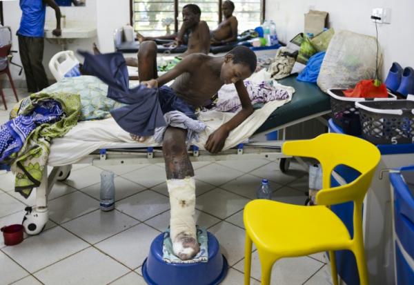Shukurani Konde Tuva (g),  souffrant d'une nécrose des tissus de sa jambe gauche causée par le venin cytotoxique provenant de la morsure d'une vipère heurtante, est pris en charge à l'hôpital du sous-comté de Malindi, le 7 avril 2025 au Kenya